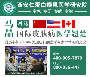 白癜风病因 白癜风病因