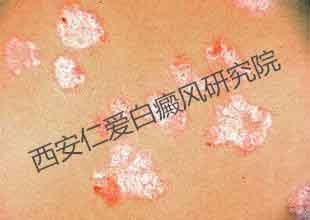 ķԭҪЩ