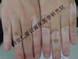 综Щ